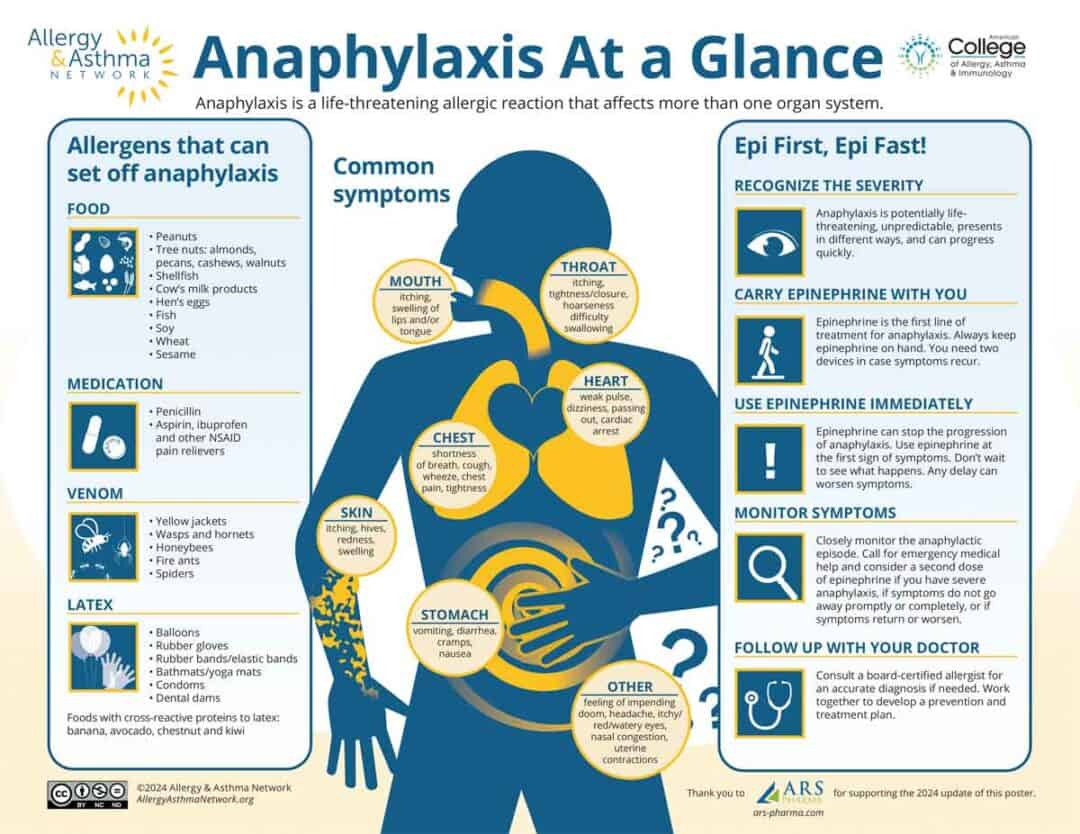 Infographic titled "Anaphylaxis At a Glance" with sections on allergens, symptoms, and emergency actions. Includes images of foods, a human outline showing symptoms, and EpiPen instructions. Logos for Allergy & Asthma Network and ARS.