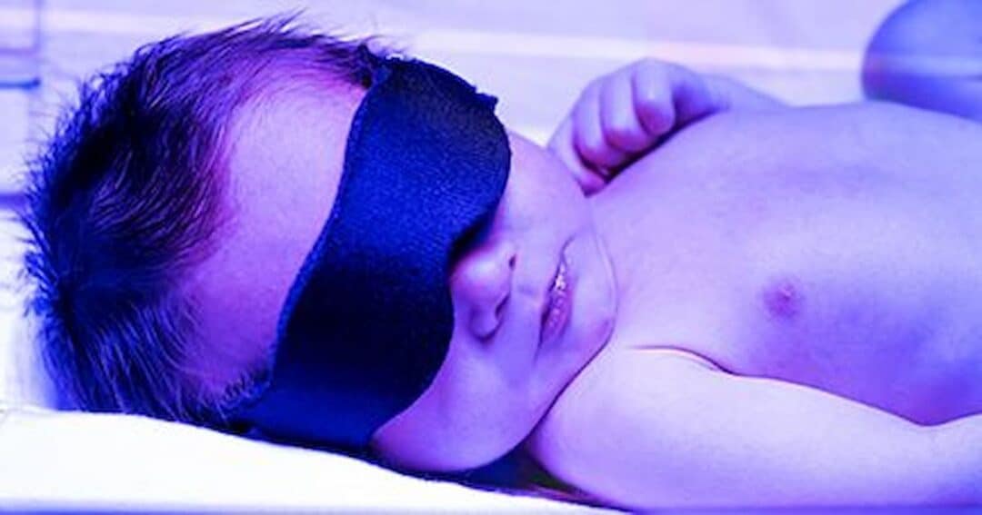 A newborn baby lies under blue phototherapy lights wearing a black eye mask, sleeping peacefully on a white surface.