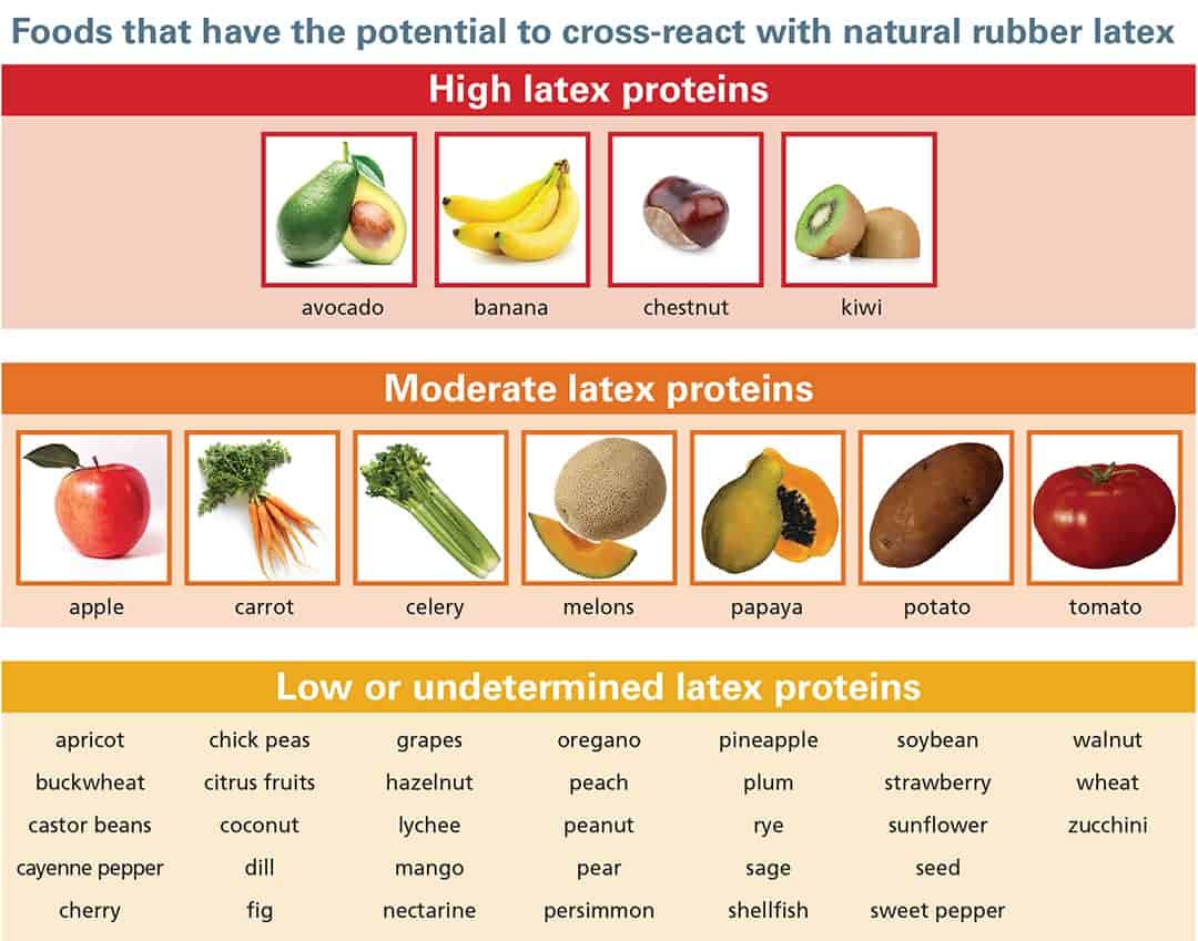 A chart categorizes foods by potential to cross-react with natural rubber latex: high latex proteins (avocado, banana, chestnut, kiwi), moderate latex proteins (apple, carrot, celery, melon), and low or undetermined latex proteins (grapes, peach, soybean, etc.).