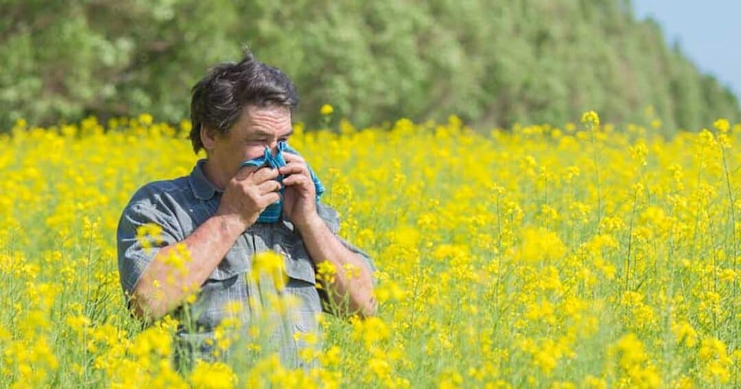 A man stands in a field of yellow flowers, holding a tissue to his nose. He appears to be sneezing or experiencing hay fever. The field is lush, with trees lining the background under a clear blue sky.