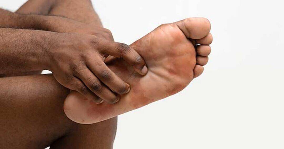 A person seated, holding and examining their bare foot. The focus is on the sole, with the other hand touching the arch, suggesting inspection or discomfort. The background is plain and neutral.